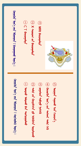 健康有方】（14）上班族预防颈椎病，从日常生活做起！3.png